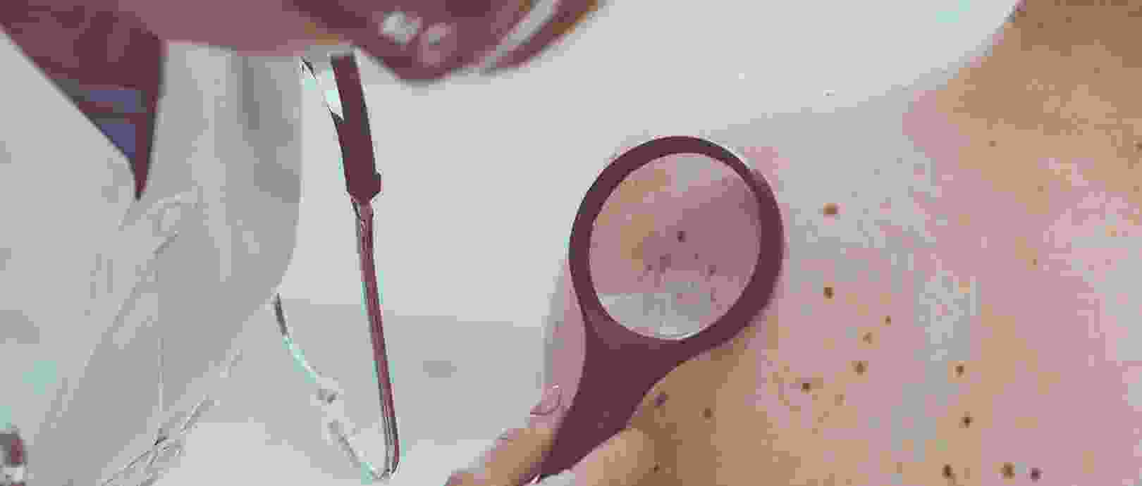 Regular skin check-ups with your dermatologist